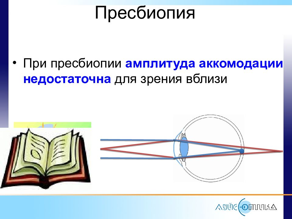 Пресбиопия что это. Пресбиопия схема. Амплитуда аккомодации. Пресбиопия что это такое рисунок. Рисунок аметропий.