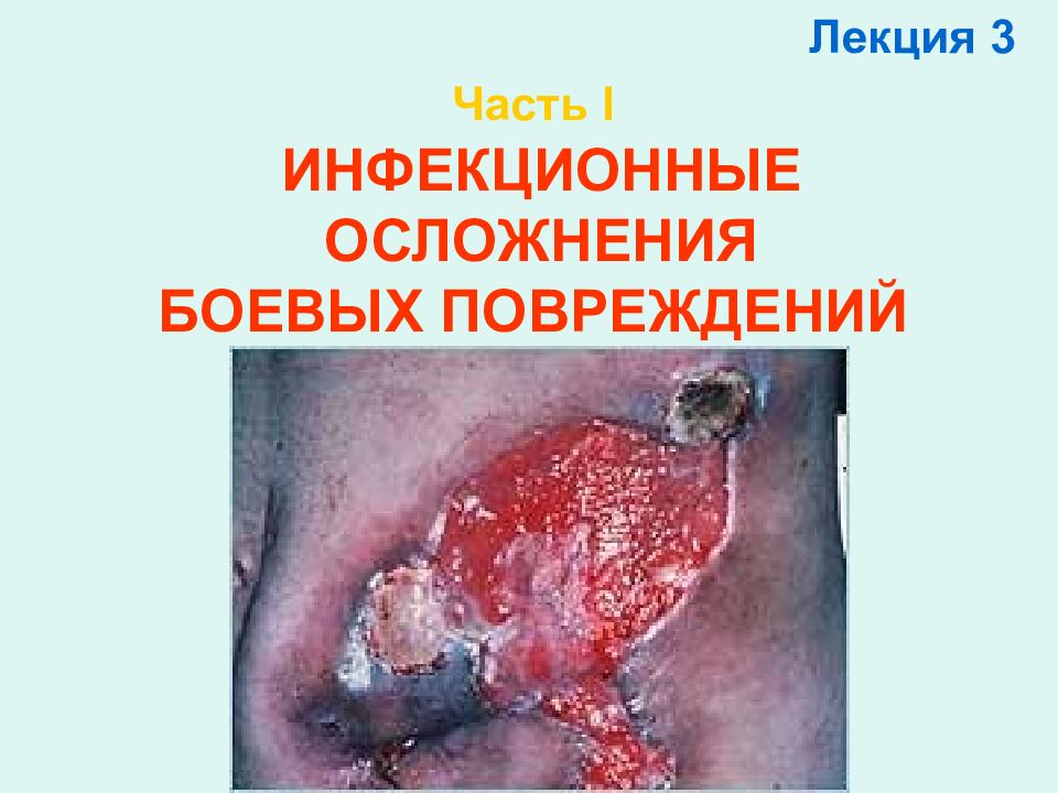 Часть I ИНФЕКЦИОННЫЕ ОСЛОЖНЕНИЯ БОЕВЫХ ПОВРЕЖДЕНИЙ