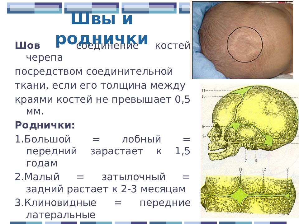 Развитие родничка. Швы костей черепа анатомия. Кости черепа роднички. Швы и роднички черепа анатомия. Швы и роднички черепа новорожденного.