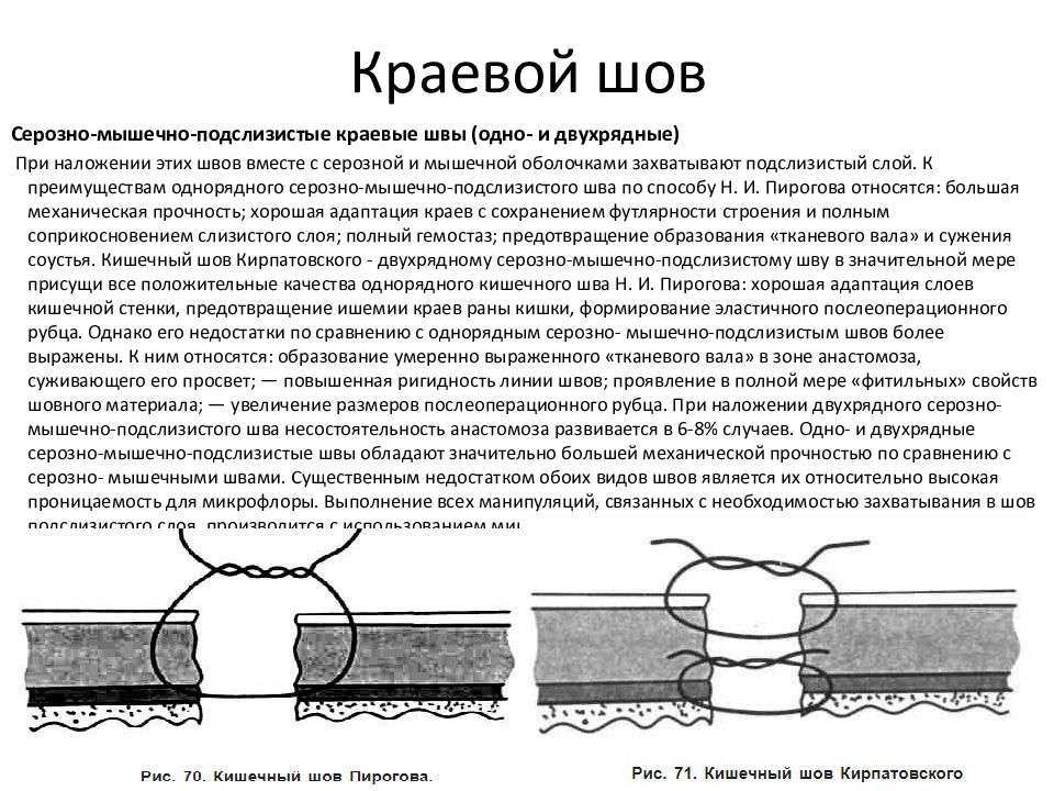 Кишечный шов