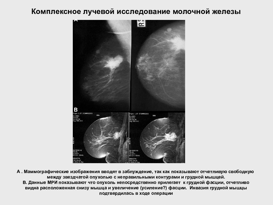 Воспаление молочных желез. Исследование молочной железы. Диагностика патологии молочной железы. Лучевая диагностика молочной железы. Заболевания молочной железы хирургия презентация.