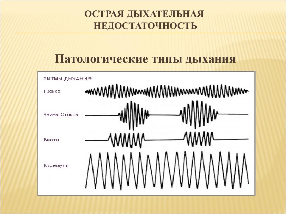 Типы дыхания картинка