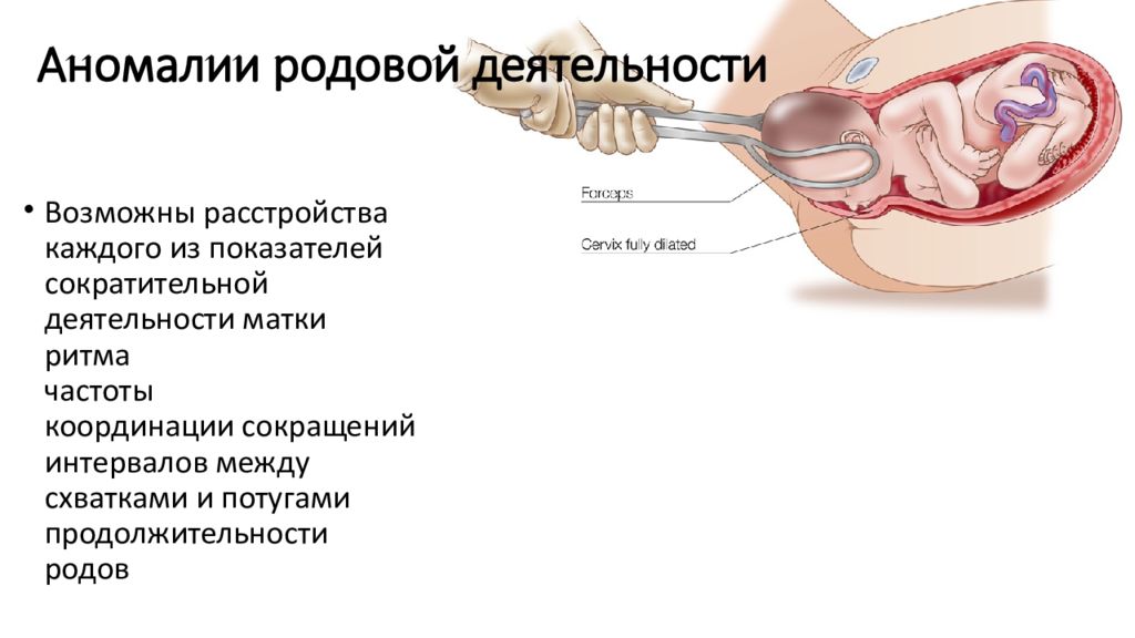 Аномалии родовой деятельности презентация