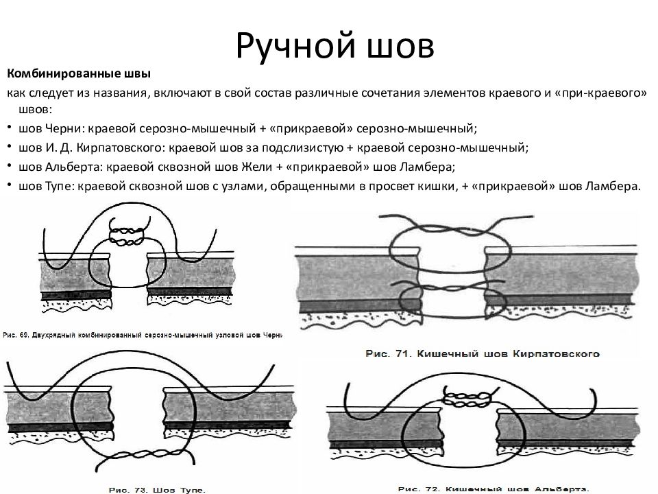 Кишечный шов презентация