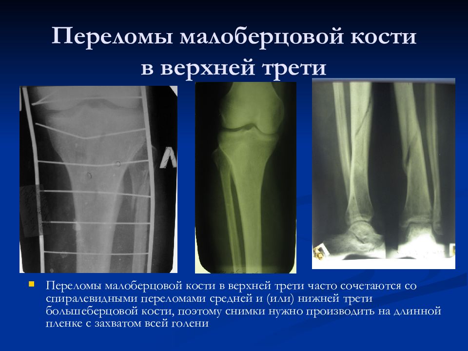 Повреждения нижних конечностей презентация