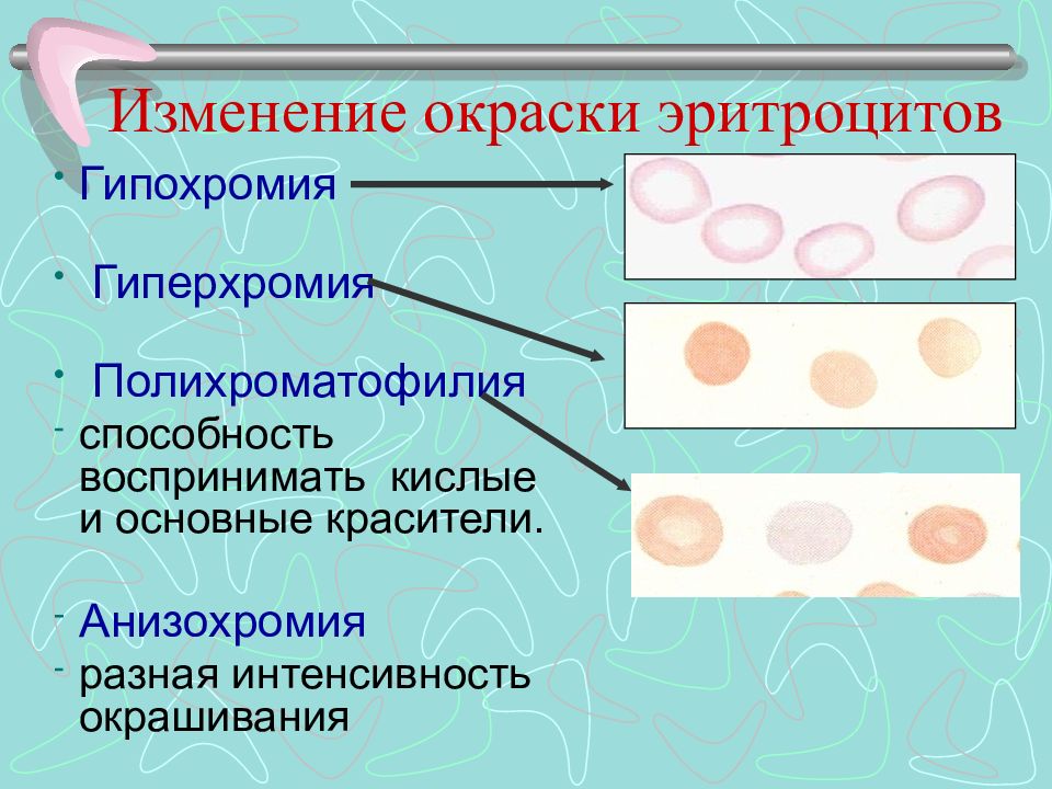 Гипохромия. Гипохромия и полихроматофилия. Гипохромия и гиперхромия. Гипохромия эритроцитов анизохромия. Нормобласты гипохромия.