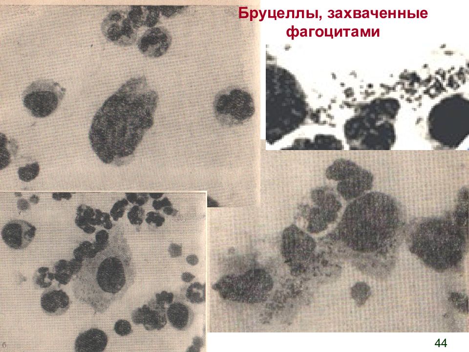 Бруцеллез презентация по микробиологии