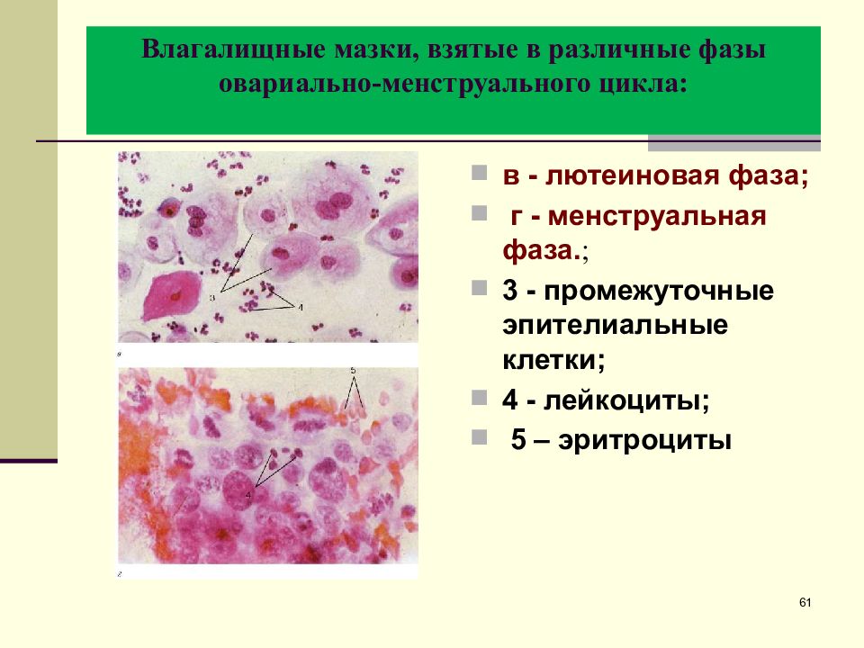 Гинекология мазок эпителий. Фазы менструационного цикла в цитологических мазках. Мазок лютеиновая фаза. Промежуточные клетки в мазке.