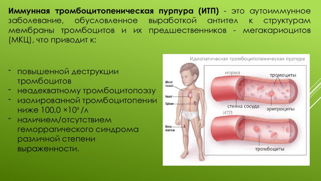 Иммунная тромбоцитопения презентация