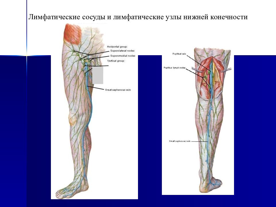 Лимфоузлы на ногах. Поверхностные лимфатические узлы бедра. Лимфатическая система нижних конечностей схема. Регионарные лимфоузлы нижней конечности. Лимфатические сосуды нижних конечностей анатомия.