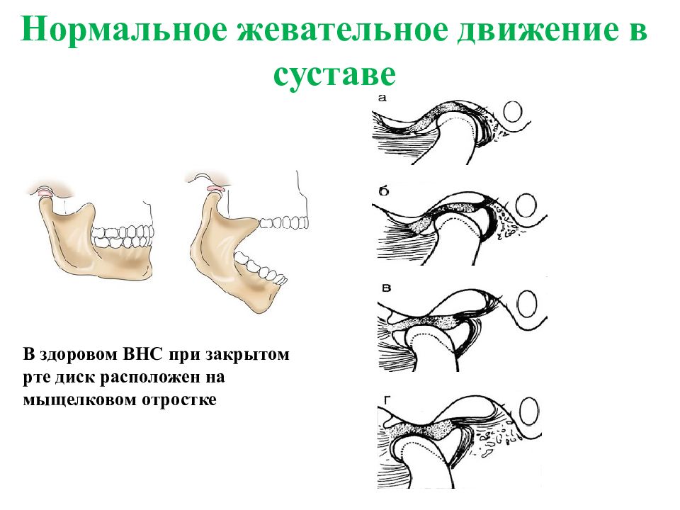 Основные принципы комплексного лечения заболеваний внчс и жевательных мышц презентация