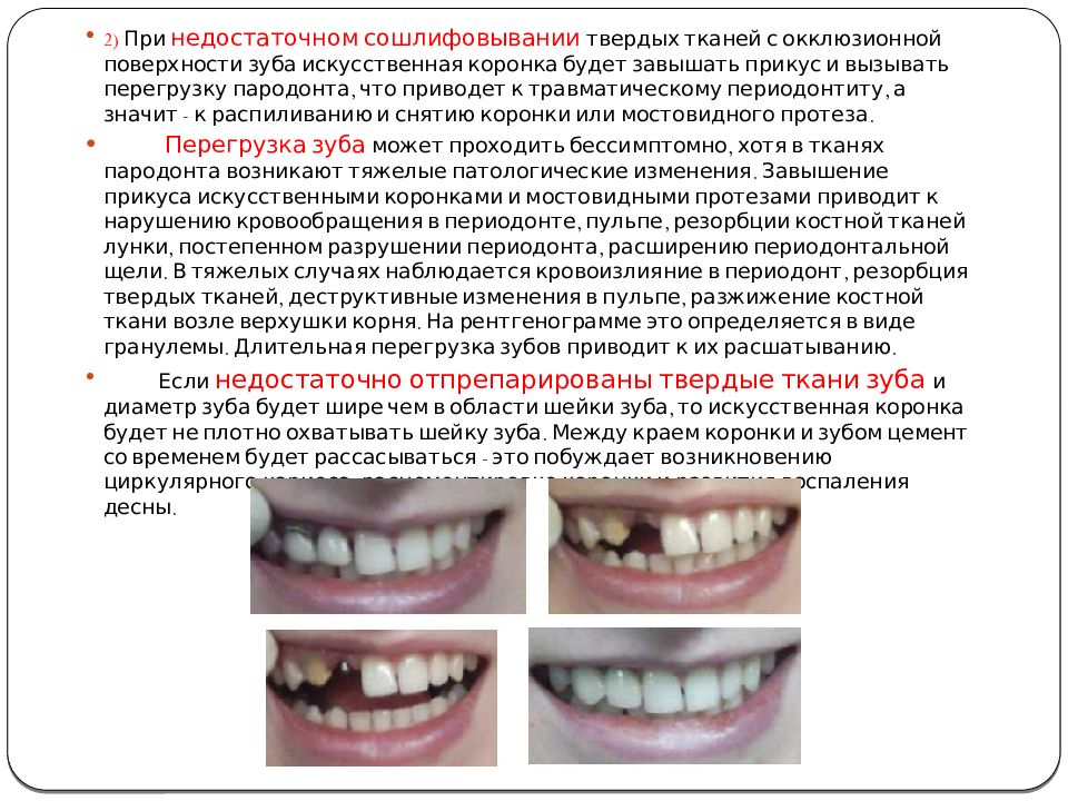 Наложение сложных шин и шин протезов реабилитация больных пародонтитом презентация