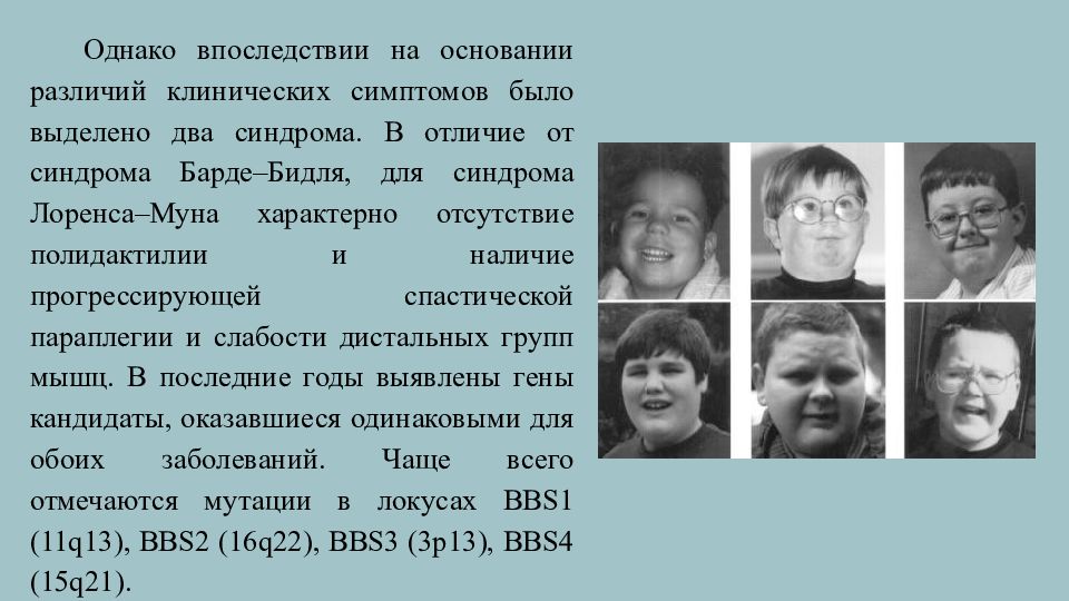 Муна барде. Наследственные синдромы. Синдром Муна-Барде-Бидля. Синдром Лоренса-Муна-Бидля.