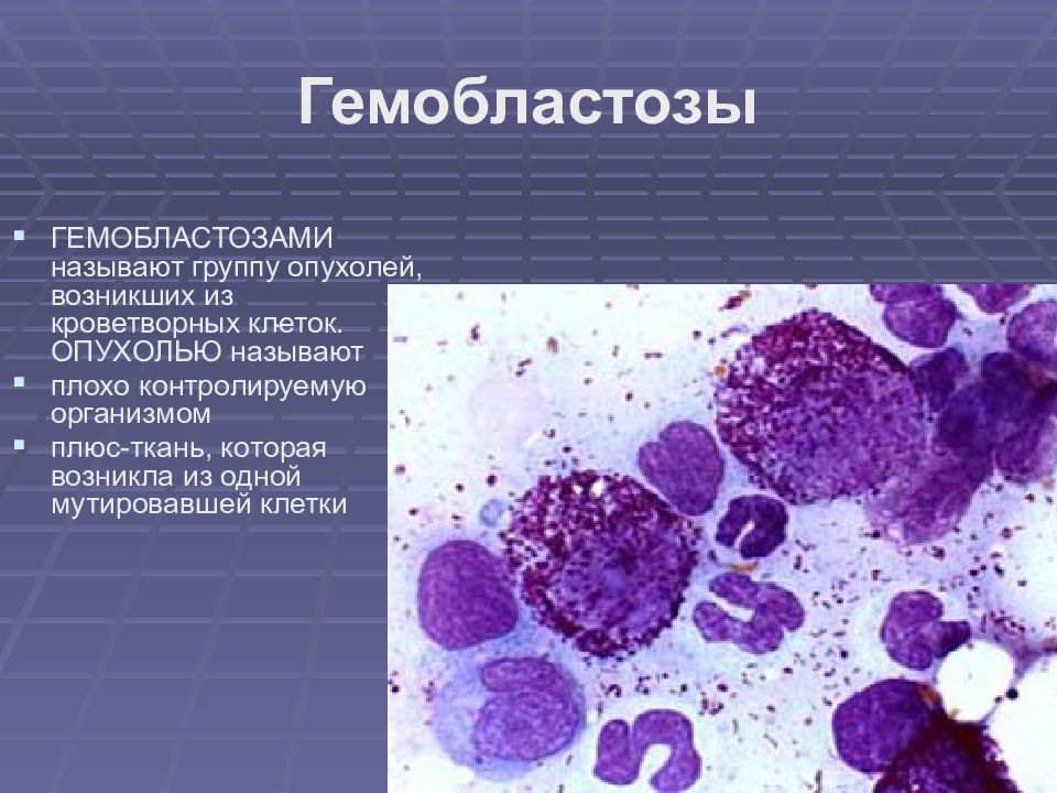 Гемобластозы это. Гемобластозы — заболевания кроветворной ткани:. Гемобластозы патологическая анатомия. Гемобластозы у детей классификация. Гемобластозы презентация.