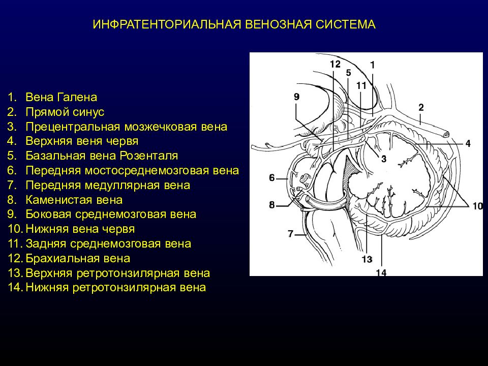 Вене галена. Вена Галена мрт анатомия. Вена Галена головного мозга. Большая мозговая Вена Галена.