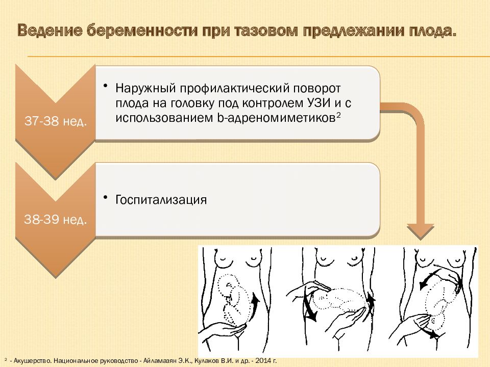 Тазовое предлежание плода акушерство презентация