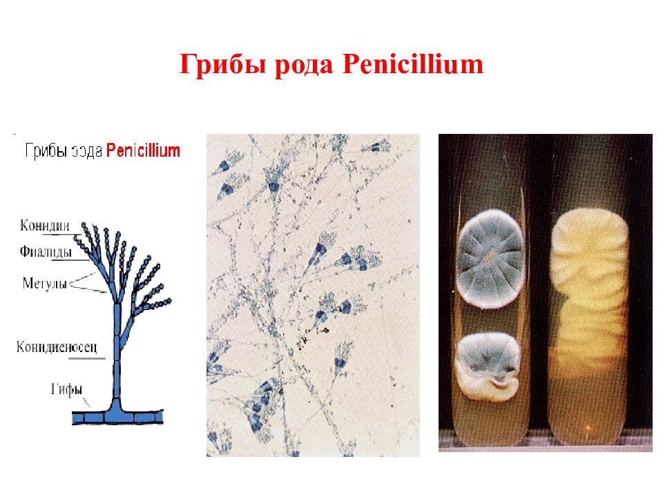 Строение пеницилла под микроскопом. Строение плесени пеницилл. Penicillium chrysogenum конидиеносцы. Пенициллин вегетативный мицелий