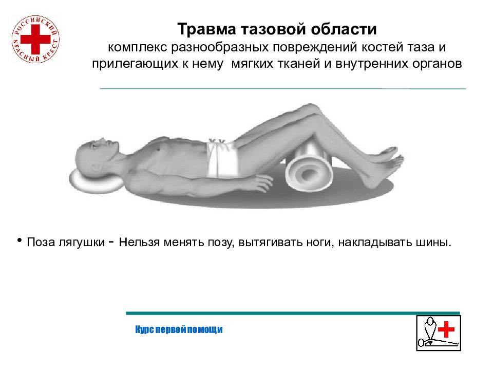 Травма таза презентация