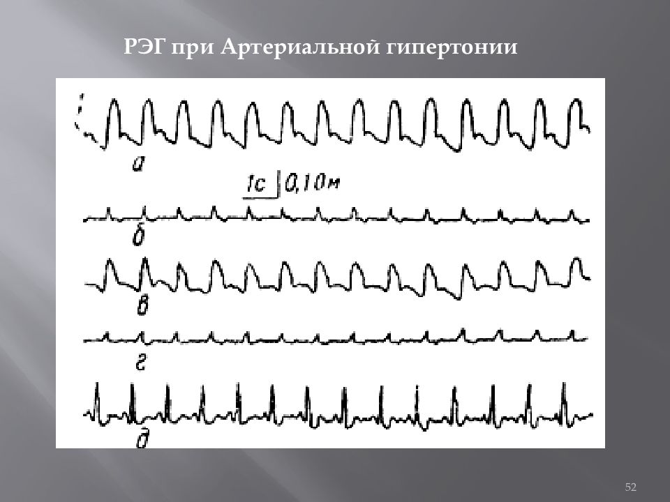 Рэг дол