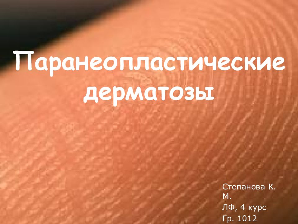 Паранеопластические дерматозы