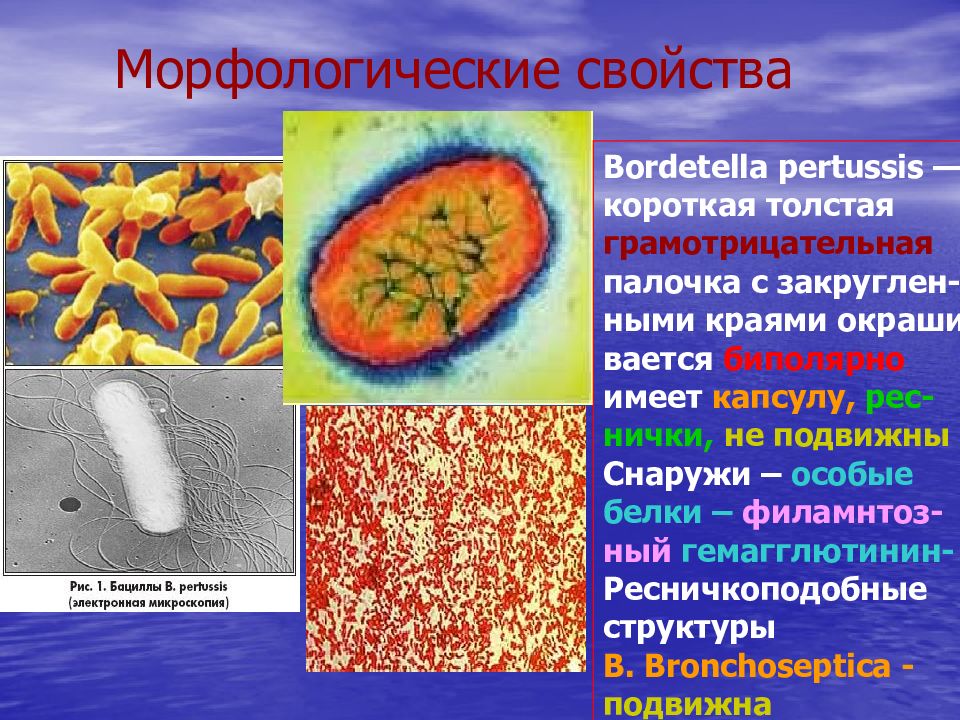 Презентация на тему коклюш микробиология