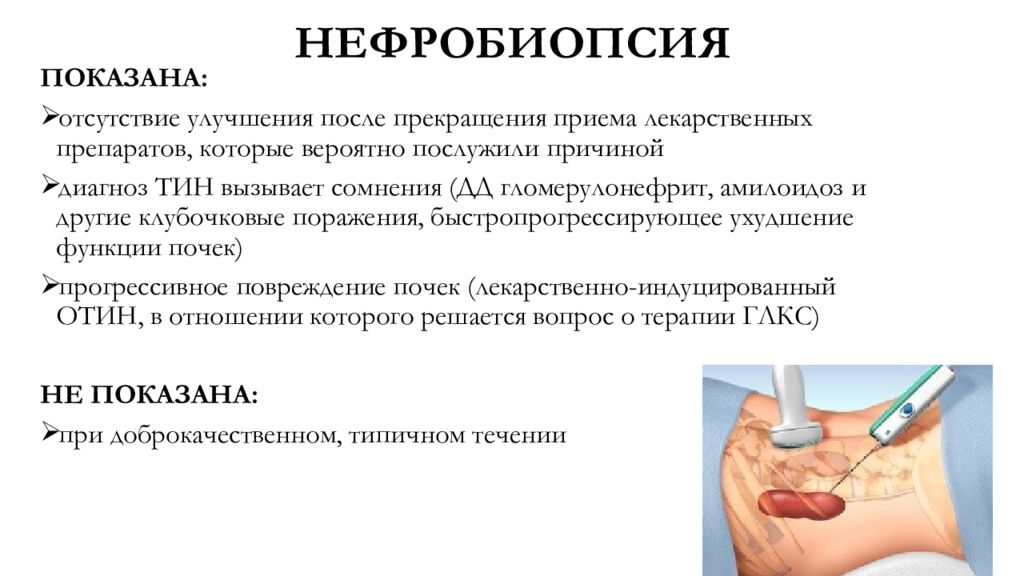 Пункция почки. Абсолютное противопоказание к нефробиопсии. Пункционная биопсия почек показания. Биопсия почки при гломерулонефрите. Показания к биопсии почки.