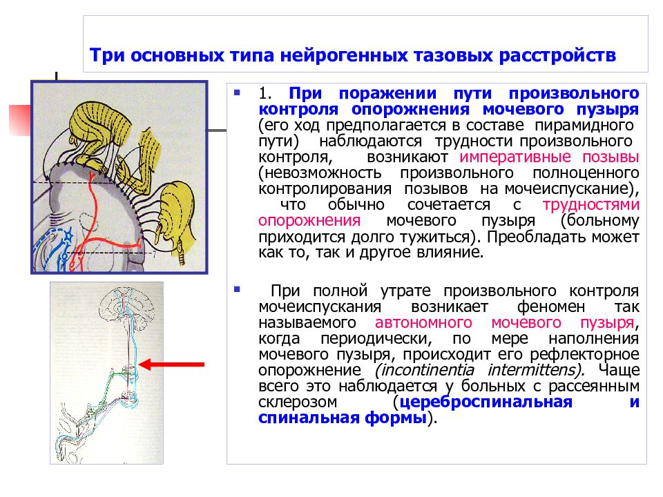 Лечение нейрогенного мочевого пузыря у женщин препараты схема