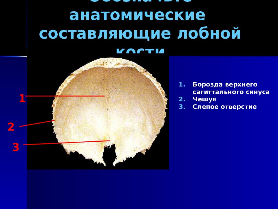 Борозды сагиттального синуса. Пластинки лобной кости. Слепое отверстие лобной кости. Борозды лобной кости. Борозда верхнего сагиттального синуса лобной кости.