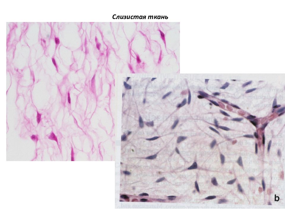 Слизистая ткань. Слизистая соединительная ткань пупочного канатика. Слизистая соединительная ткань препарат. Слизистая студенистая соединительная ткань. Слизистая соединительная ткань гистология.