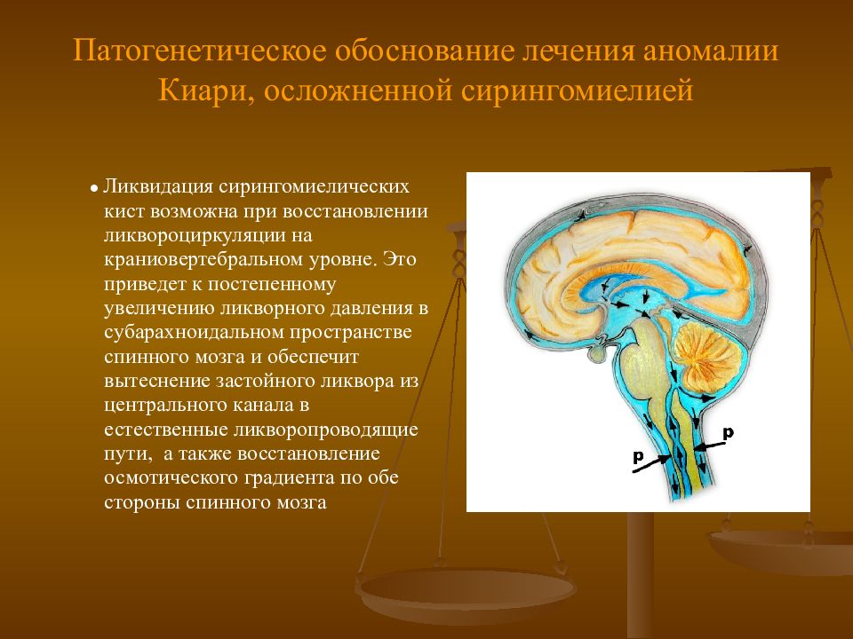 Ликворные пространства головного. Ликворные пространства. Ликворная система головного мозга. Ликворные пространства мозга. Ликвородинамика головного мозга.