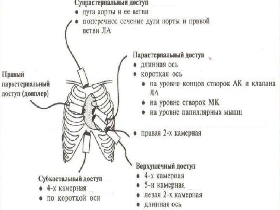 Узи сердца схема