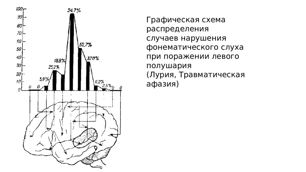 причины появления афазии. травматическая афазия. травматическая афазия. травматическая афазия лурия. травматическая афазия лурия методы.