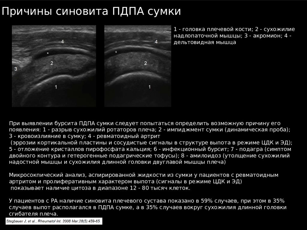 Протокол узи локтевого сустава образец