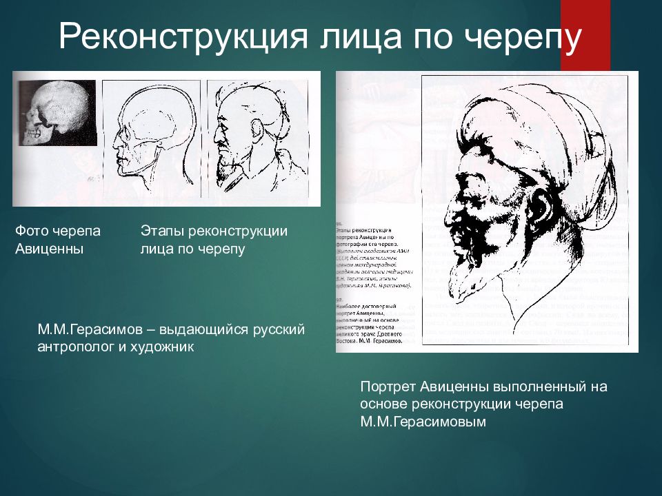 На рисунке изображены череп и реконструкция иностранцевии. Этапы развития черепа в онтогенезе. Краниология в антропологии.