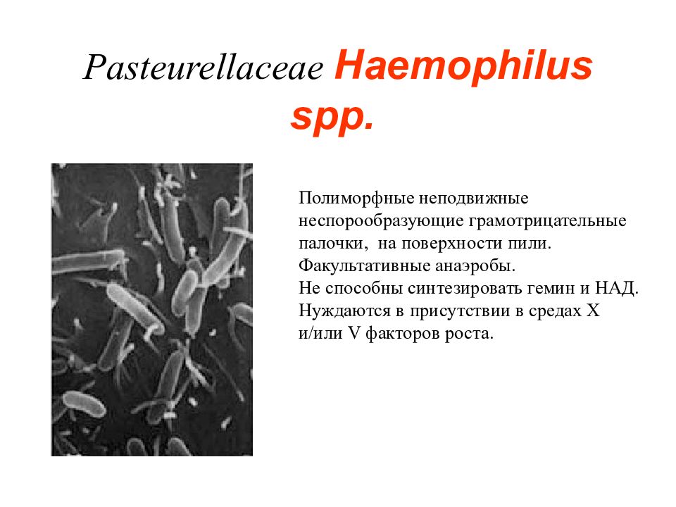 Haemophilus spp в мазке у мужчины. Гемофильная палочка аэроб или анаэроб. Грамотрицательные неспорообразующие палочки.