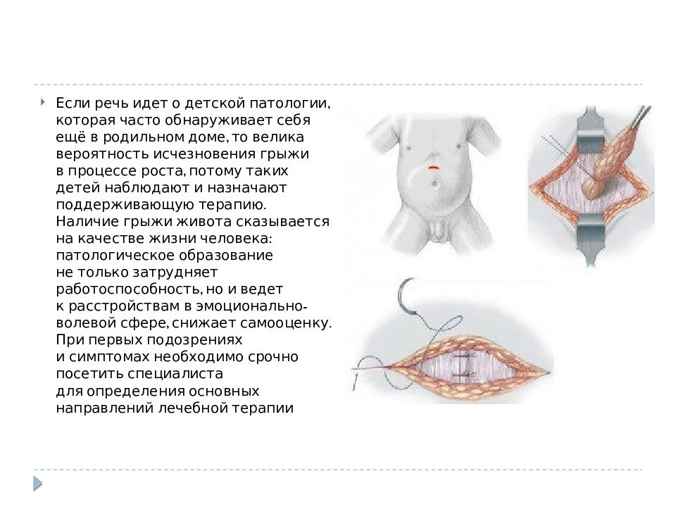 Презентация грыжи живота хирургия