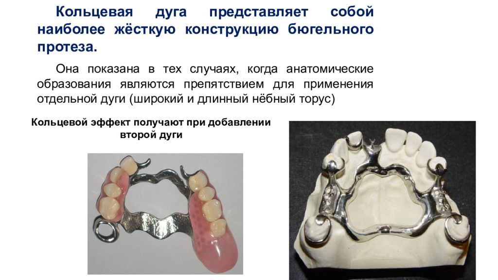 Частичные дефекты зубных рядов