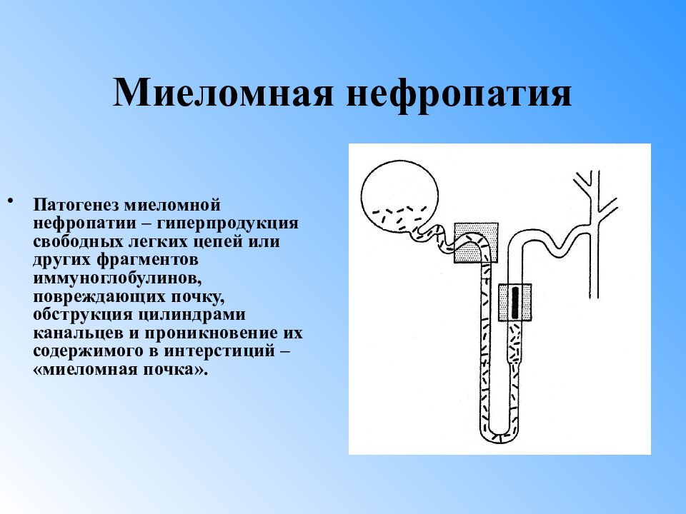 Миеломная болезнь презентация