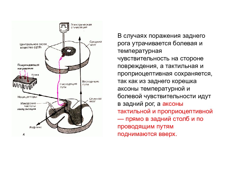 Блок схема болевого анализатора