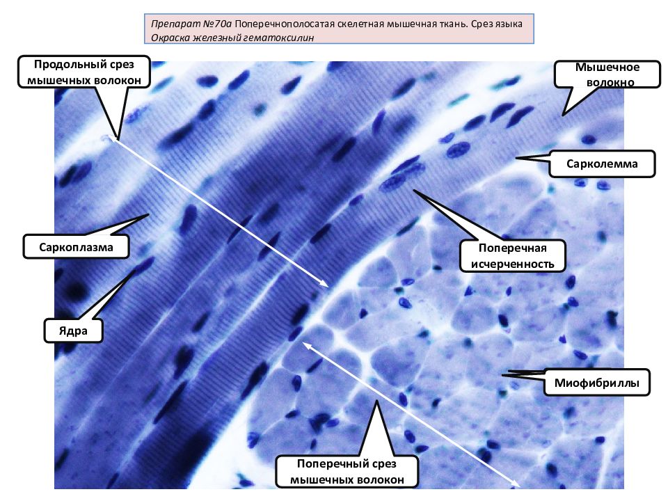 Мышечные волокна препарат. Препарат поперечно полосатая мышечная ткань Железный гематоксилин. Поперечно полосатая Скелетная мышечная ткань Железный гематоксилин. Поперечно-полосатая мышечная ткань препарат гистология. Поперечнополосатая Скелетная мышечная ткань препарат.