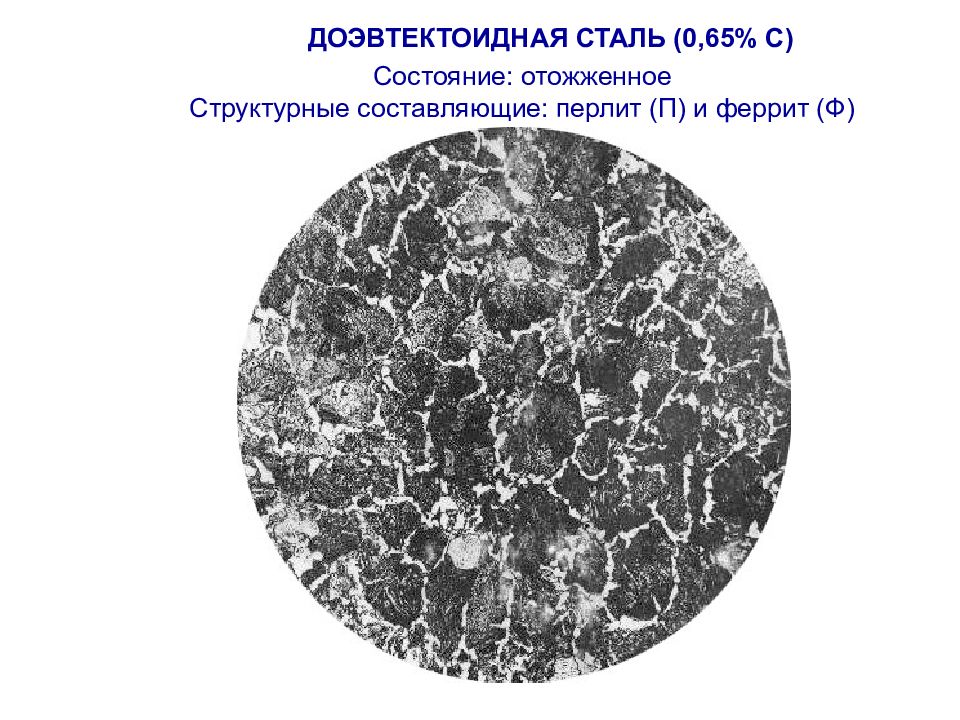 Составляющая стали. Микроструктура стали 45 феррит перлит. Доэвтектоидная сталь феррит перлит. Микроструктура доэвтектоидной стали у15. Доэвтектоидная феррит перлит.