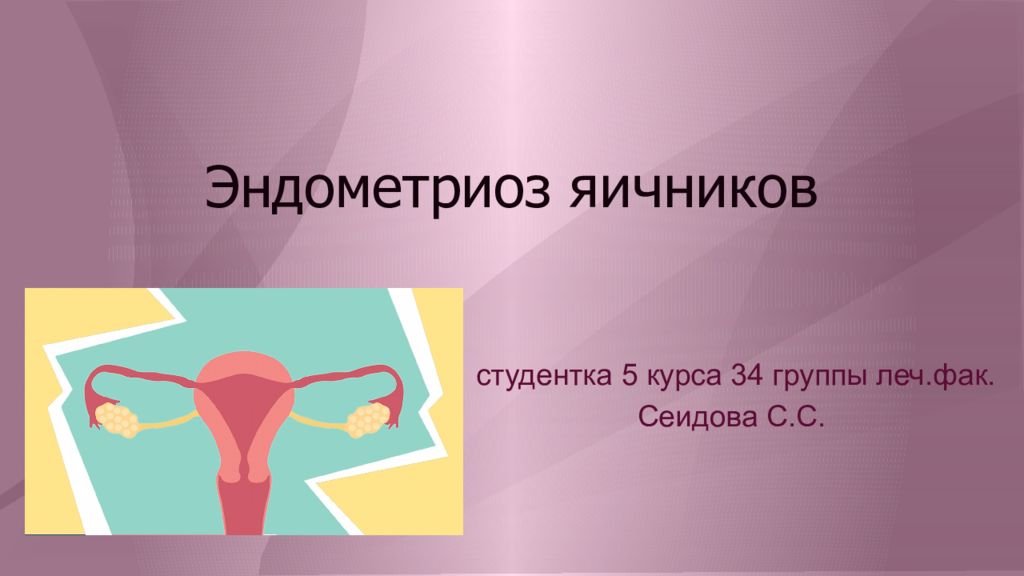 Эндометриоз яичников