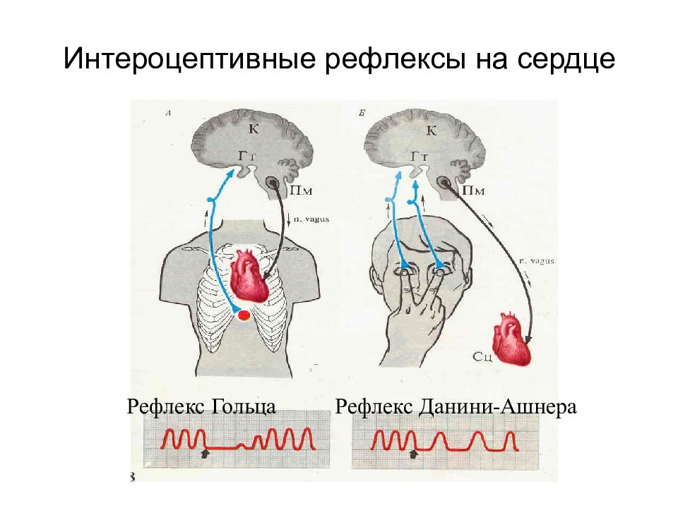 Глазосердечный рефлекс схема