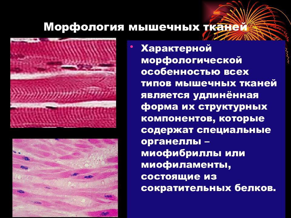 Поперечнополосатая скелетная мышечная ткань особенности строения. Структура мышечной ткани. Морфология мышечной ткани. Строение поперечно полосатой мышечной ткани. Характеристика мышечной ткани.