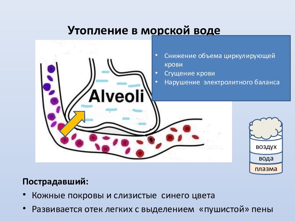 Клиническая картина утопление