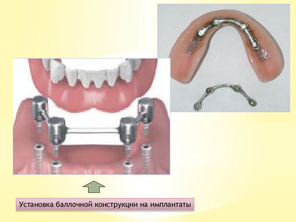 Система фиксации речи