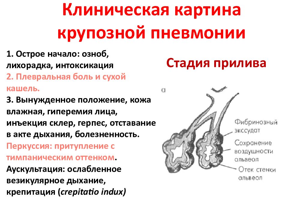 Клиническая картина пневмонии. Клиническая картина крупозной пневмонии. Клинические симптомы крупозной пневмонии. Крупозная пневмония жалобы. Клинические стадии крупозной пневмонии.