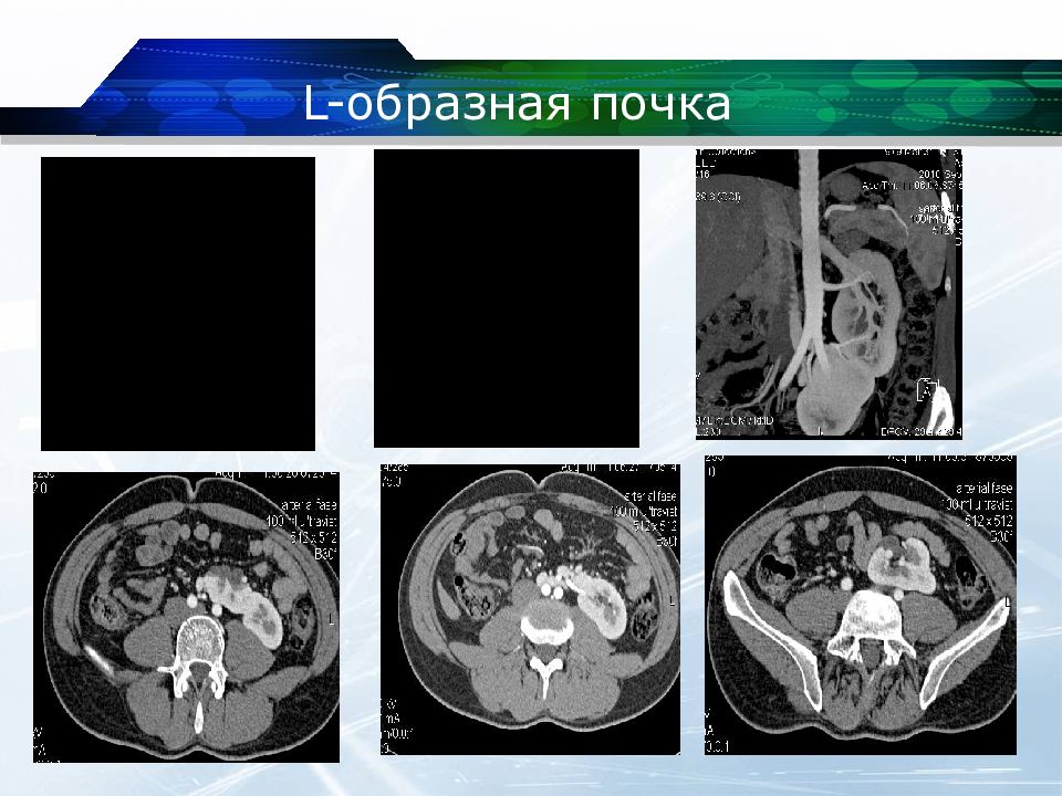 Кт почек презентация