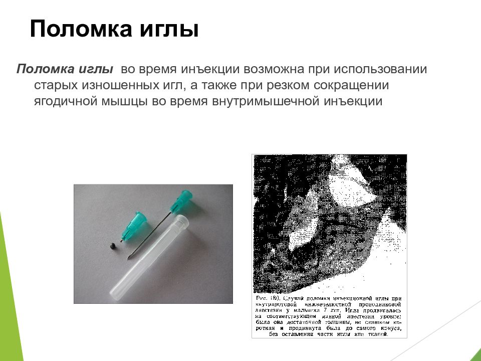 Поломка машинной иглы. Поломка иглы происходит если. Поломка иглы причины возникновения. Поломка иглы причины. Причиной поломки иглы может быть.