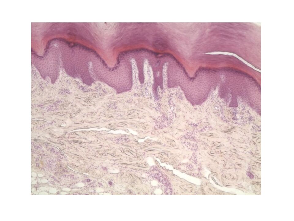 Кожа и ее производные